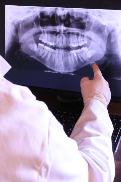 Best Chipped Tooth Repair Near Me  in Gberts, IL