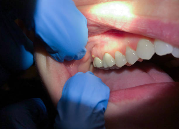Best Urgent Tooth Repair  in Gberts, IL