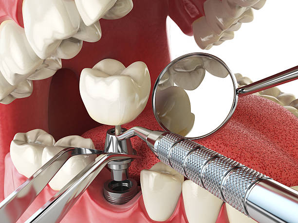 Best Tooth Pain Emergency Relief  in Gberts, IL